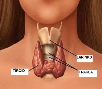 Tiroid yüksek çıkması neden olur?